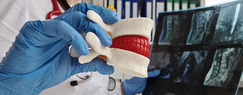 patient receiving herniated disc in Corte Madera