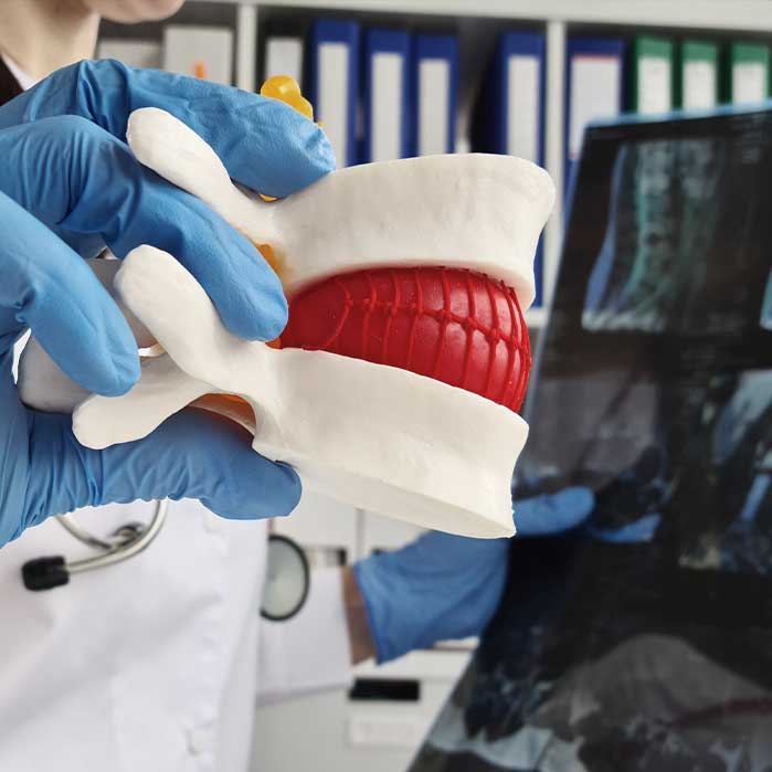 slipped disc chiropractor in Corte Madera CA